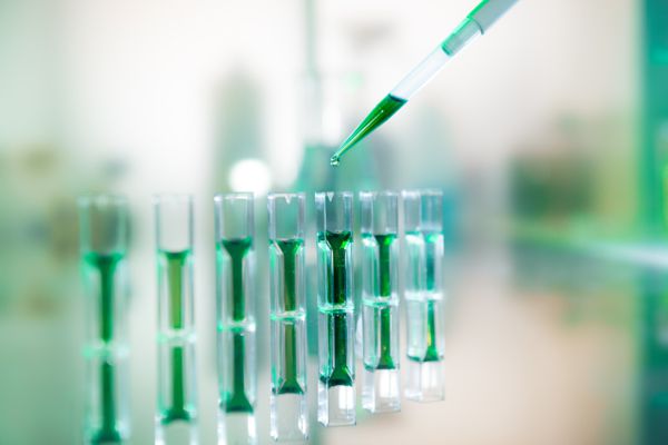 Consultá por nuestros Planes de análisis a medida